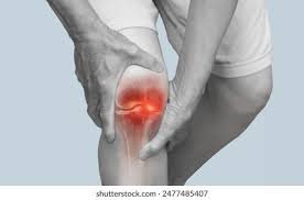 Meniscus tear